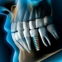 Imagem 5 da empresa DENTISTA SORRIDERE PORTO ALEGRE - CLÍNICA ODONTOLÓGICA Dentistas em Porto Alegre RS