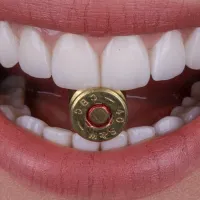 Imagem 7 da empresa DENTISTA SORRIDERE PORTO ALEGRE - CLÍNICA ODONTOLÓGICA Dentistas em Porto Alegre RS