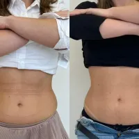 Imagem 2 da empresa JULIA DERETTI NUTRICIONISTA Nutricionistas em Itajaí SC