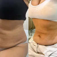 Imagem 3 da empresa JULIA DERETTI NUTRICIONISTA Nutricionistas em Itajaí SC