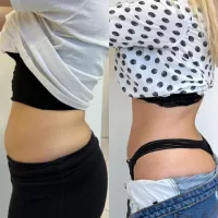 Imagem 4 da empresa JULIA DERETTI NUTRICIONISTA Nutricionistas em Itajaí SC