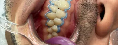 Imagem 1 da empresa CLÍNICA ALMEIDA ODONTOLOGIA | DENTÍSTICA | INVISALIGN | HARMONIZAÇÃO FACIAL Clínicas Odontológicas em São Paulo SP