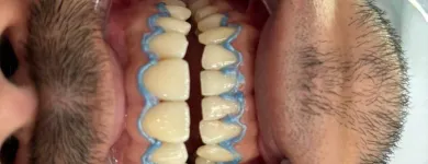 Imagem 2 da empresa CLÍNICA ALMEIDA ODONTOLOGIA | DENTÍSTICA | INVISALIGN | HARMONIZAÇÃO FACIAL Clínicas Odontológicas em São Paulo SP