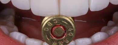 Imagem 7 da empresa DENTISTA SORRIDERE PORTO ALEGRE - CLÍNICA ODONTOLÓGICA Dentistas em Porto Alegre RS