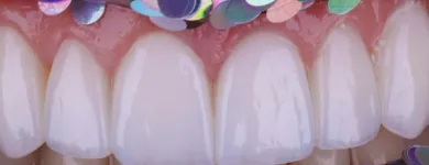 Imagem 8 da empresa DENTISTA SORRIDERE PORTO ALEGRE - CLÍNICA ODONTOLÓGICA Dentistas em Porto Alegre RS