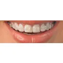 DRA MAIRA TOLFO PORTO ORTODONTIA Dentistas em Porto Alegre RS